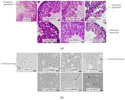 The testis is the site where spermatogenesis and spermiogenesis occur within the study the table and diagram of the testes, epididymis, and ductus deferens, noting their locations, features, and functions for correlation with the. Ijms Free Full Text N Butyldeoxygalactonojirimycin Induces Reversible Infertility In Male Cd Rats Html