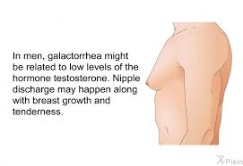 Image result for Galactorrhea
