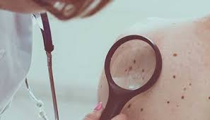 Affected women may experience psychological distress and impaired social functioning. Platelet Rich Plasma Prp Treatment Johns Hopkins Medicine