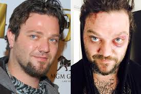 Brandon cole margera, better known as bam margera, was born on september 28, 1979 in west chester, pennsylvania, to april margera (née cole) and phil margera. Bam Margera Attacked At Music Festival In Iceland Page Six