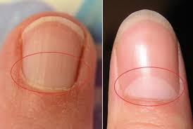 You'll find it in rich and velvety sauces, soups, and desserts. What Does The Half Moon Shape On Your Nails Mean