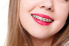 Webmd explains commonly used drugs in dental care. Teeth Emotions Health People Dentist And Lifestyle Concept Healthy Beautiful Smile The Child To The Dentist Portrait Of A Little Girl With Orthodontic Appliance Stock Photo Picture And Royalty Free Image Image