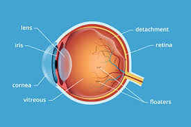 Image result for Floaters