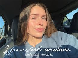 Accutane Experience: Benefits and Side Effects