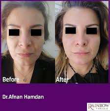 Dr. Afnan Hamdan د....