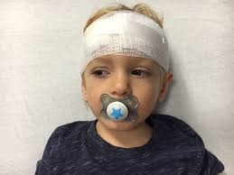 Peaks and troughs and the upside of space