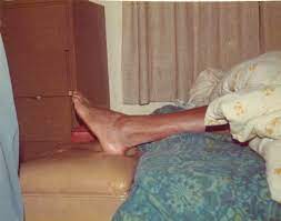 Wilt chamberlain said there never were any little wilties. that may not have been true. The Early Years With Wilt Chamberlain Completept Pool Land Physical Therapy