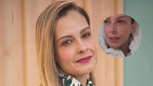 Laura Acuña se arrepiente de automedicarse y lamenta las consecuencias:  "¡Qué cosa tan horrorosa!" | Red+ Noticias 15 Minutos