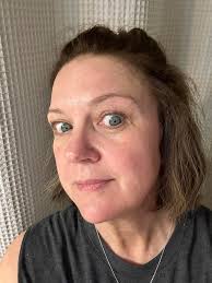 Should I continue using skin products despite irritation?