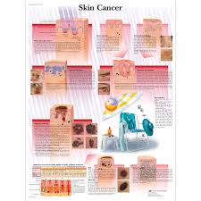 skin cancer chart