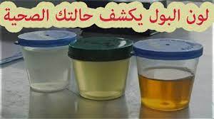 الوان البول بالصور ازاى اعرف انى حامل من لون البول ابداع افكار