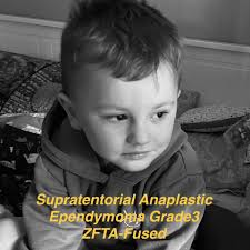 Childhood brain tumors are the leading cause of cancer deaths in children  and the most diagnosed cancer in those 14 years old and younger.  Unfortunately, no treatments are specifically developed and approved