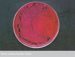 Salmonella bacteria typically live in animal and human intestines and are shed through feces. Salmonella Enteritidis On Xld Agar Download Scientific Diagram