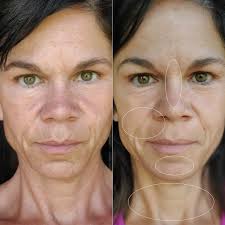 Gin Amber's 0.5mm Dermaroller