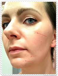 A full review on clinique's even better foundation. Clinique Even Better Glow Light Reflecting Makeup Broad Spectrum Spf 15 Foundation A Lightweight And Runny Foundation From The Famous Brand Light Coverage And Visible Flaking Does It Cover My Pigment