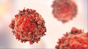Burkitt`s lymphoma cells, is a cancer of the lymphatic system. Why Do Hodgkin S Lymphoma Cells Grow Uncontrollably Technology Networks