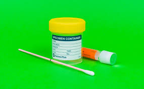 Daskalakis is the deputy commissioner of disease control for the department of health in new york city. How Do I Know If I Have An Sti