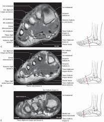 These muscles begin and attach within the skeleton of the foot, have complex anatomical and topographical and functional relationships with. Foot Ankle And Calf Musculoskeletal Key