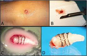 Their larvae are internal parasites of mammals. First Report Of Autochthonous Furuncular Myiasis Caused By Dermatobia Hominis In Europe Journal Of Infection