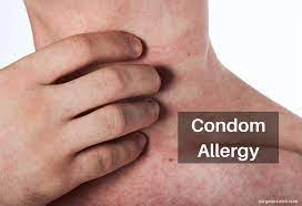 Maybe you would like to learn more about one of these? Condom Allergy Itchy Condoms Surgeon4men Penis Enlargement