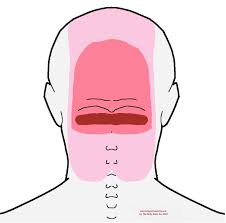 Pin On Headache Trigger Point Pain