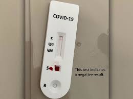 Scientific Community Still Debating Antibodies Testing Future Protection Against Covid 19 The Daily Courier Prescott Az