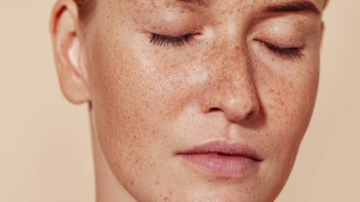 Pigmentation Treatment in Dubai: What Causes Skin Pigmentation?