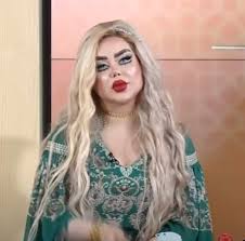 A “famous” Iraqi tv presenter : rBotchedsurgeries