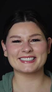 Transforming Taylor Paul's Smile: The Power of Small Changes