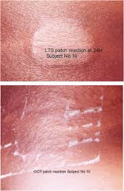 Image result for Oncinotis