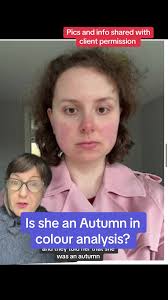 Carol Brailey Freckle