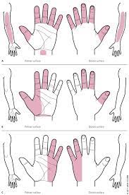 Carpal Tunnel Syndrome American Family Physician