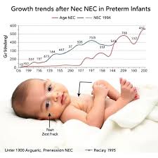 Image result for Preterm Infant Growth