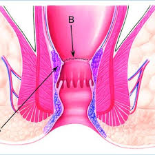 Operation trust was a bolshevik counterintelligence operation run from 1921 to 1926 aimed at neutralizing opposition by creating the false impression that a powerful group of military leaders had. Pdf Techniques Avec Agrafeuse Transanale Des Hemorroides Au Prolapsus Rectal