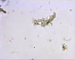 Amoeba is a unicellular organism in the kingdom protozoa. Live Amoeba 100x General Biology Lab Loyola University Chicago