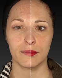 Clinique D Dermato-esthétique (@cliniqued_dermatoesthetique) · Laval, QC