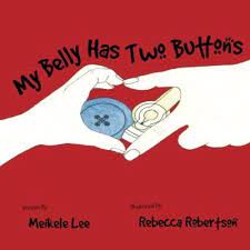 My Belly Has Two Buttons A Tubie Story Feeding Tube Feeding Tube Awareness Tubie