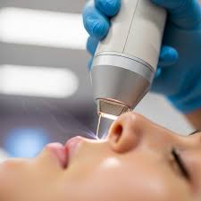 إليكِ تقنيات التجميل بالليزر ومميزاتها لبشرة ناعمة ونضرة - مجموعة الموسى  الصحية