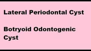 Lateral Periodontal Cyst Botryoid Odontogenic Cyst Youtube
