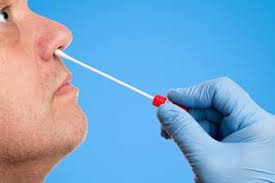 Accurate Influenza Testing Possible With Midturbinate Nasal Swabs Alameda Health System