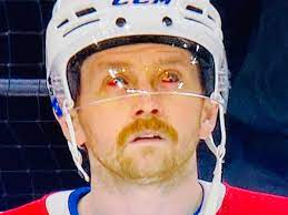 Petry missed the past two games after suffering a hand injury in the second round against the his eyes have looked like that for a week now, said petry's defensive partner, joel edmundson. Nk6 Kjkxilktbm