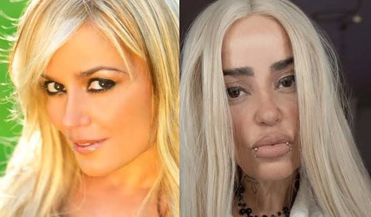 Surge notícia sobre a cantora Ruth Marlene de 48 anos