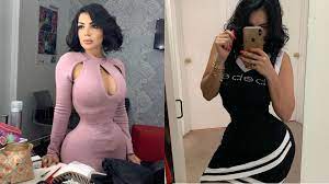 La Barbie Latina' lleva 38 cirugías y recomienda a las jóvenes no recurrir  a ellas