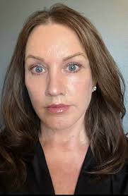 Woman, 66, Got a Facelift So Shocking, the Internet Thought It Was Fake:  PHOTOS (Exclusive)