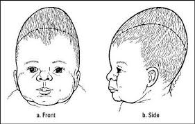 Image result for Vacuum Caput