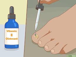 When nails grow long, they often catch on surfaces such as carpet, for instance. How To Help A Toenail Grow Back Quickly Toe Nails Ingrowing Toe Nail Hair And Nails