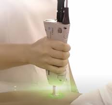 I would highly recommend this location for your hair removal needs. Laser Hair Removal Knox Laser Skin Solutions