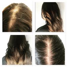 Women S Hair Integration Systems London Hair Enhancers Wig Hairstyles Human Hair Wigs