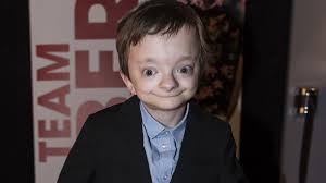 Jul 30, 2021 · danish youtuber albert dyrlund has died in an accident at the age of 22. Albert Dyrlund Shefalitayal