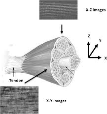 Its morphology in the native solid state, methods of identification and characterization and chemical modifications, as well as the difficulties in utilizing and processing it. Study Of Optical Properties And Proteoglycan Content Of Tendons By Polarization Sensitive Optical Coherence Tomography